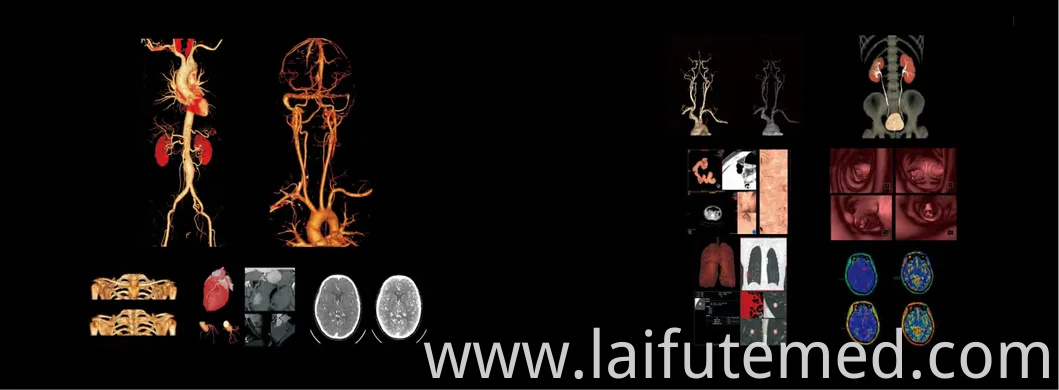 Advanced 512 Slice CT Scanner for Veterinary Imaging-High-Resolution 3D Diagnostics for Large Animals